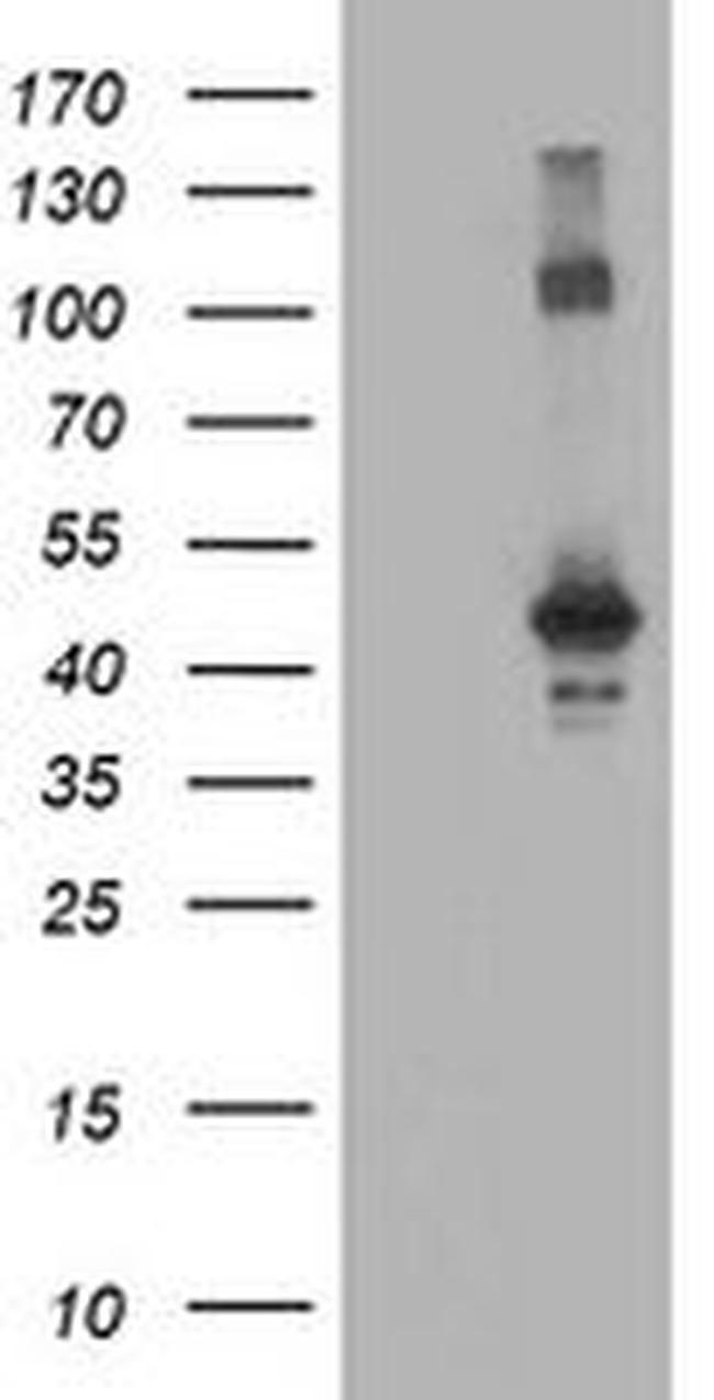 CCM2 Antibody in Western Blot (WB)