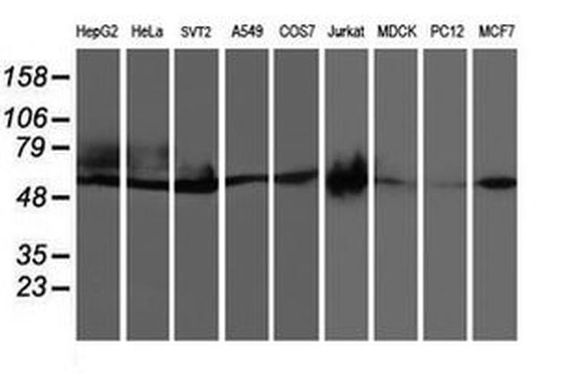 CCM2 Antibody in Western Blot (WB)