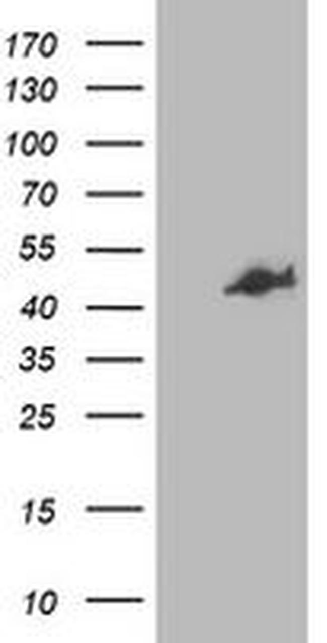 CCM2 Antibody in Western Blot (WB)