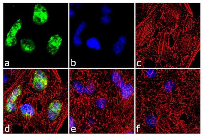 Cyclin A2 Antibody in Immunocytochemistry (ICC/IF)