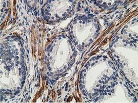 CCNB1IP1 Antibody in Immunohistochemistry (Paraffin) (IHC (P))