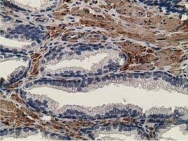 CCNB1IP1 Antibody in Immunohistochemistry (Paraffin) (IHC (P))