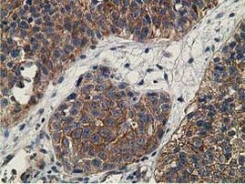 CCNB1IP1 Antibody in Immunohistochemistry (Paraffin) (IHC (P))