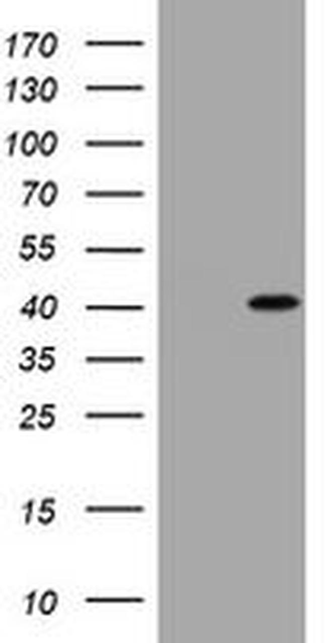 CCND1 Antibody in Western Blot (WB)