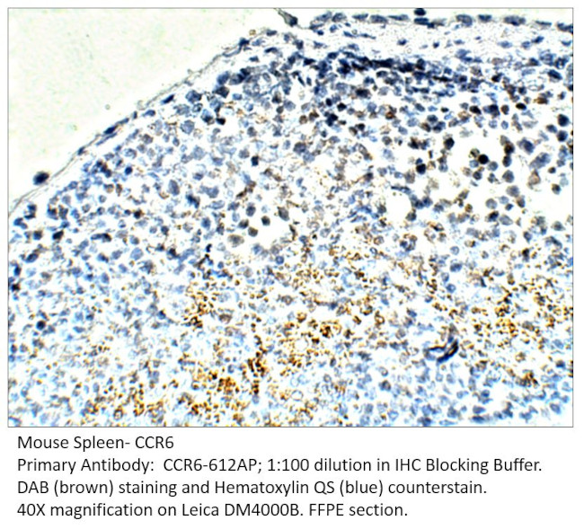 CCR6 Antibody in Immunohistochemistry (IHC)