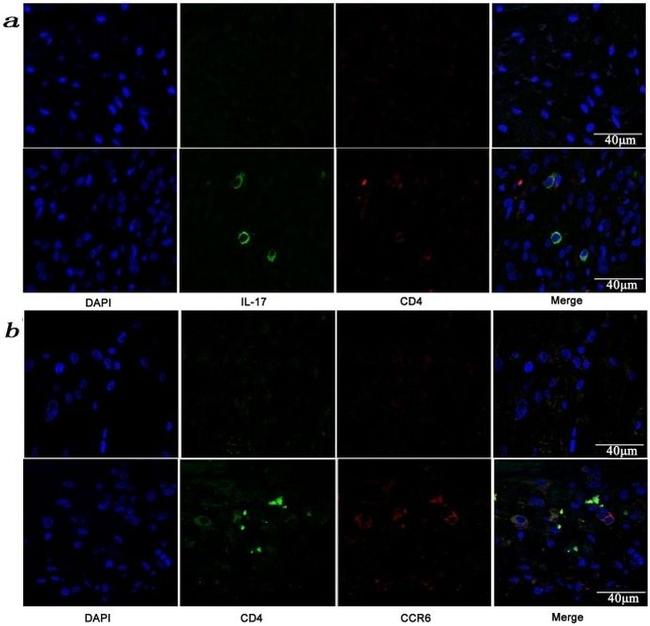 CD196 (CCR6) Antibody in Immunocytochemistry (ICC/IF)