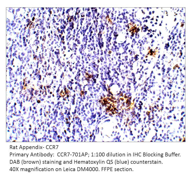 CCR7 Antibody in Immunohistochemistry (IHC)