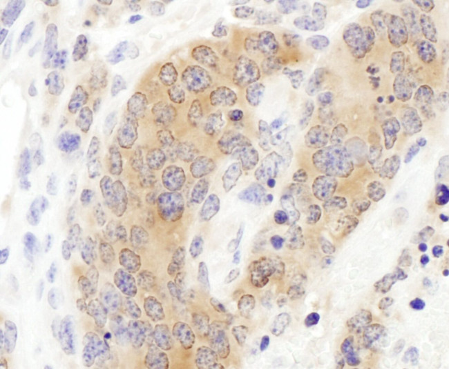 CCT3 Antibody in Immunohistochemistry (IHC)