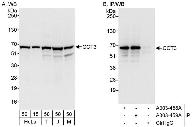 CCT3 Antibody in Western Blot (WB)