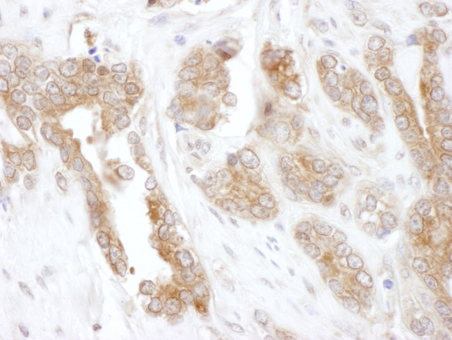 CCT5 Antibody in Immunohistochemistry (IHC)