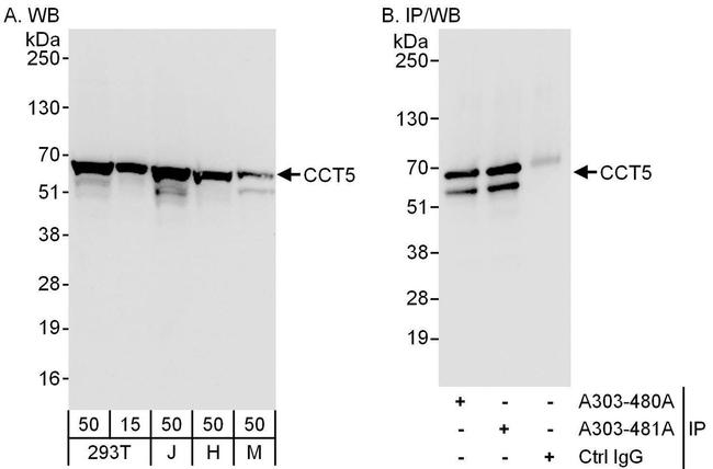 CCT5 Antibody in Western Blot (WB)