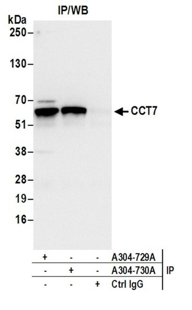 CCT7 Antibody in Immunoprecipitation (IP)