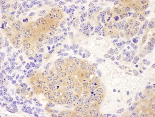 CCT8 Antibody in Immunohistochemistry (IHC)