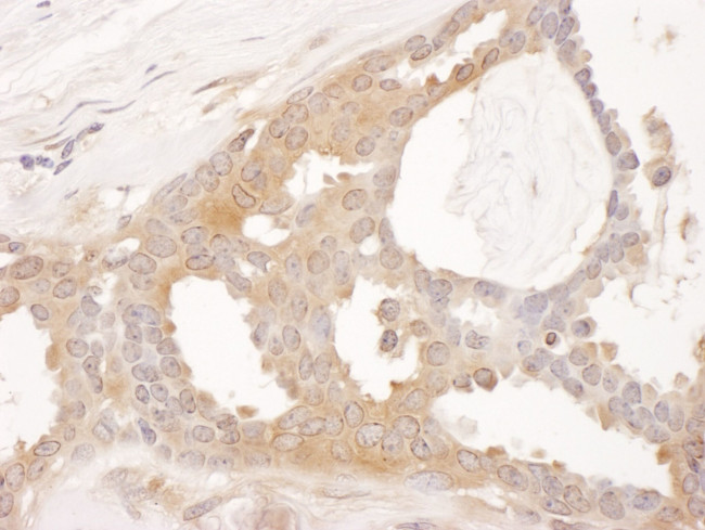 CCT8 Antibody in Immunohistochemistry (IHC)