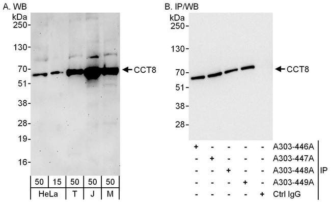 CCT8 Antibody in Western Blot (WB)