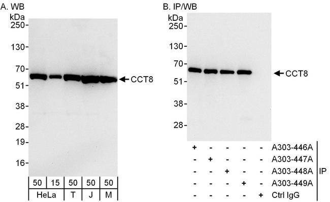 CCT8 Antibody in Western Blot (WB)