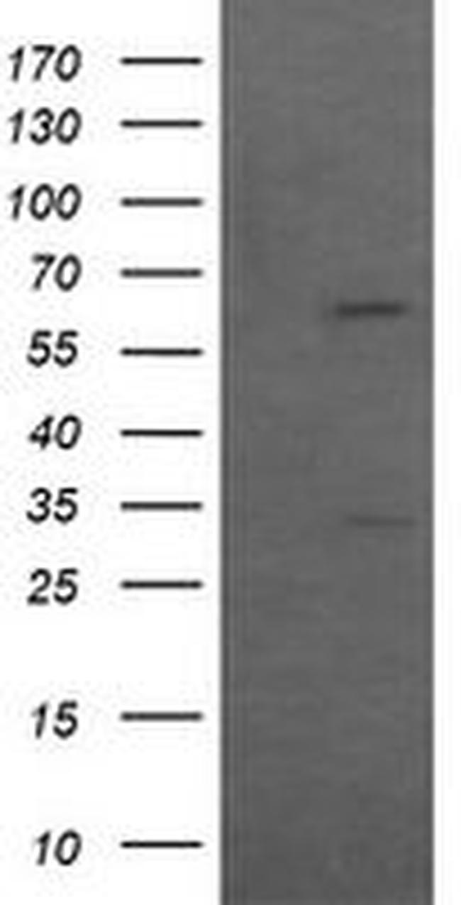 CCT8L2 Antibody in Western Blot (WB)