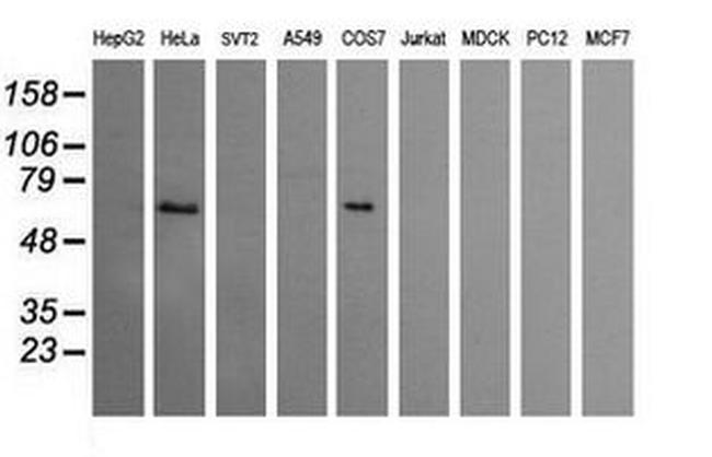 CCT8L2 Antibody in Western Blot (WB)