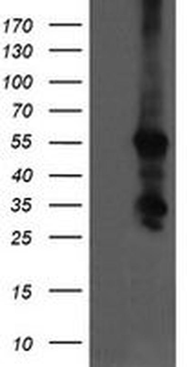 CCT8L2 Antibody in Western Blot (WB)