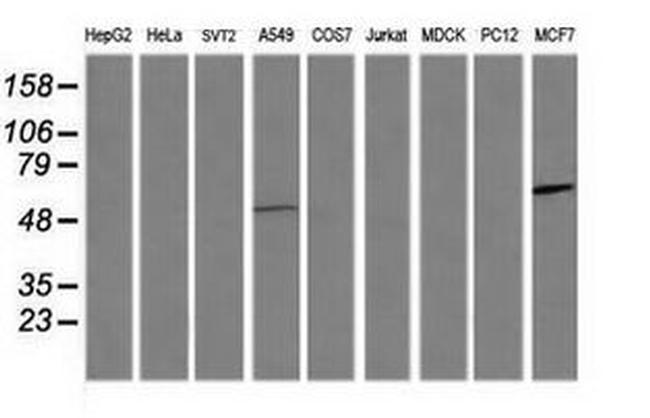 CCT8L2 Antibody in Western Blot (WB)