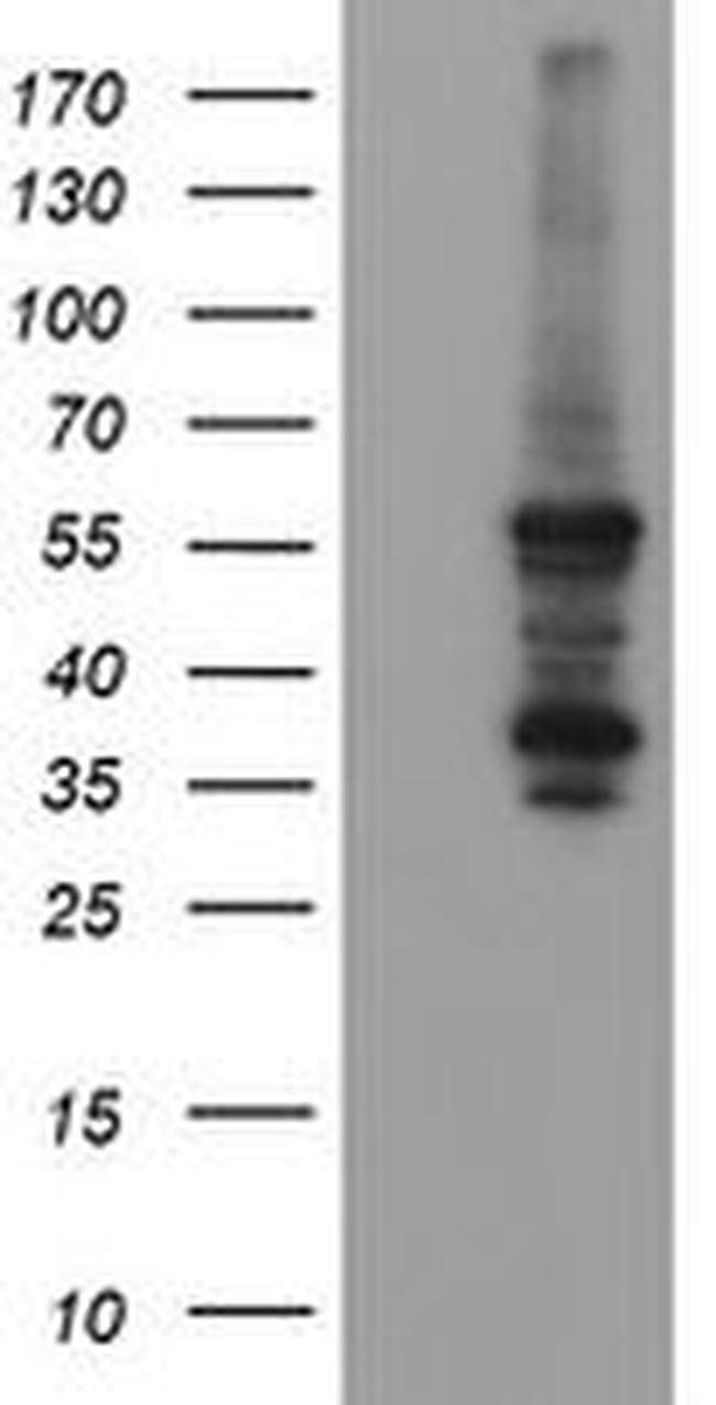 CCT8L2 Antibody in Western Blot (WB)