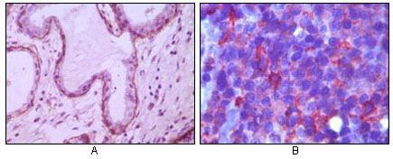 CD10 Antibody in Immunohistochemistry (Paraffin) (IHC (P))