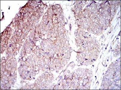 CD104 Antibody in Immunohistochemistry (Paraffin) (IHC (P))