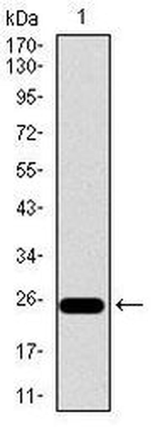 CD104 Antibody in Western Blot (WB)