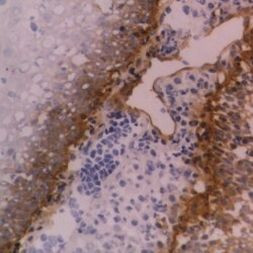 CD104 Antibody in Immunohistochemistry (Frozen) (IHC (F))