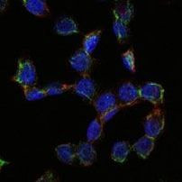 CD105 Antibody in Immunocytochemistry (ICC/IF)