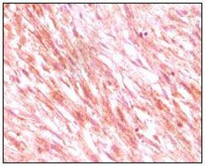 c-Kit Antibody in Immunohistochemistry (Paraffin) (IHC (P))