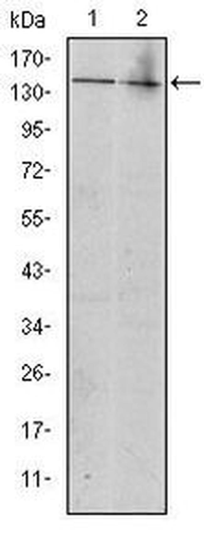 c-Kit Antibody in Western Blot (WB)