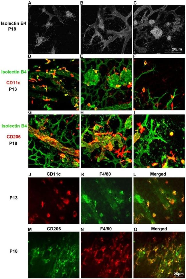 CD11c Antibody in Immunohistochemistry (IHC)