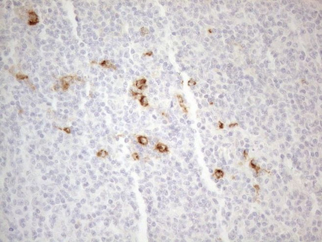 CD13 Antibody in Immunohistochemistry (Paraffin) (IHC (P))