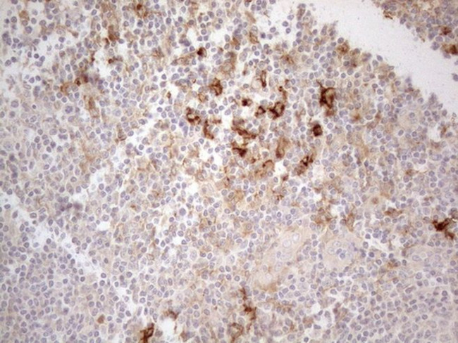 CD13 Antibody in Immunohistochemistry (Paraffin) (IHC (P))