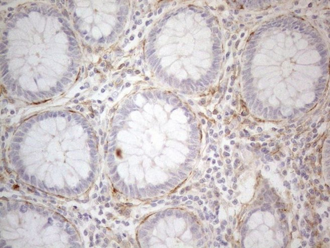 CD13 Antibody in Immunohistochemistry (Paraffin) (IHC (P))