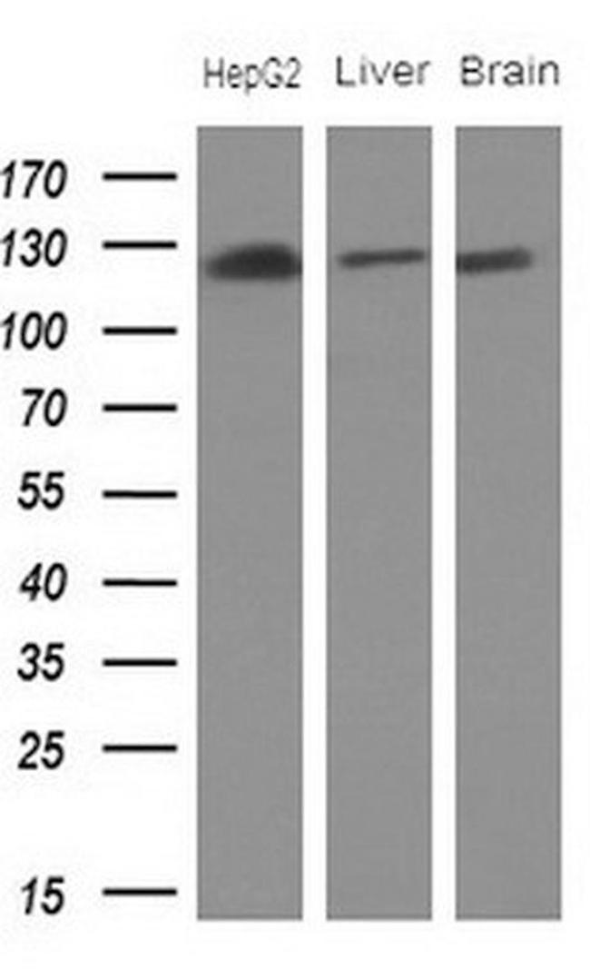 CD13 Antibody in Western Blot (WB)