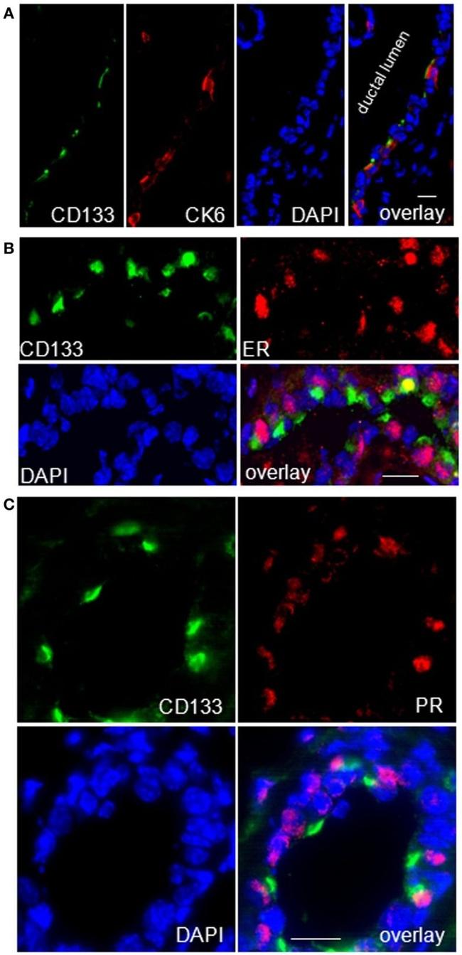 CD133 (Prominin-1) Antibody in Immunohistochemistry (IHC)