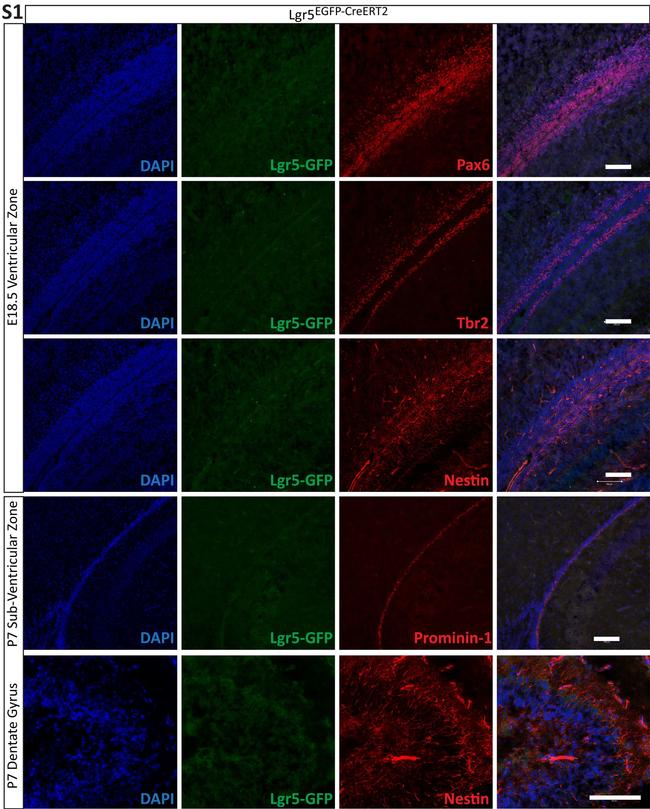 CD133 (Prominin-1) Antibody in Immunohistochemistry (IHC)