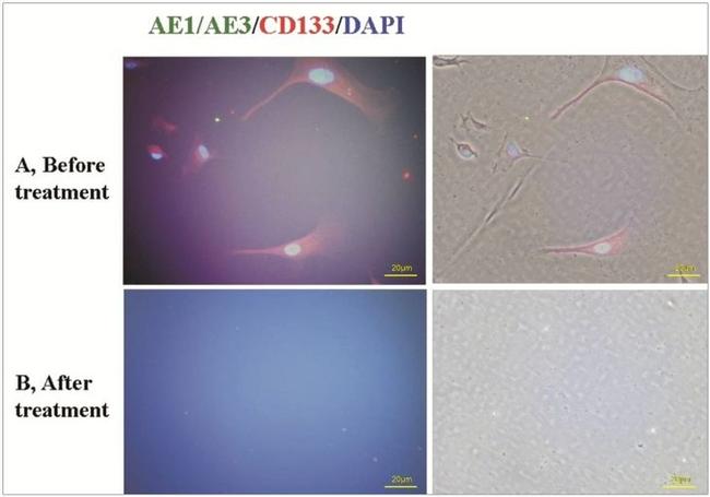 CD133 (Prominin-1) Antibody in Immunocytochemistry (ICC/IF)