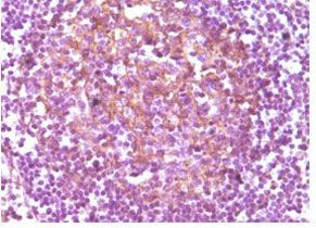 CD14 Antibody in Immunohistochemistry (Paraffin) (IHC (P))