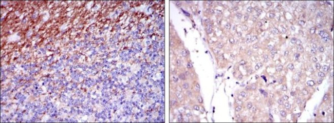 SSEA1 Antibody in Immunohistochemistry (Paraffin) (IHC (P))