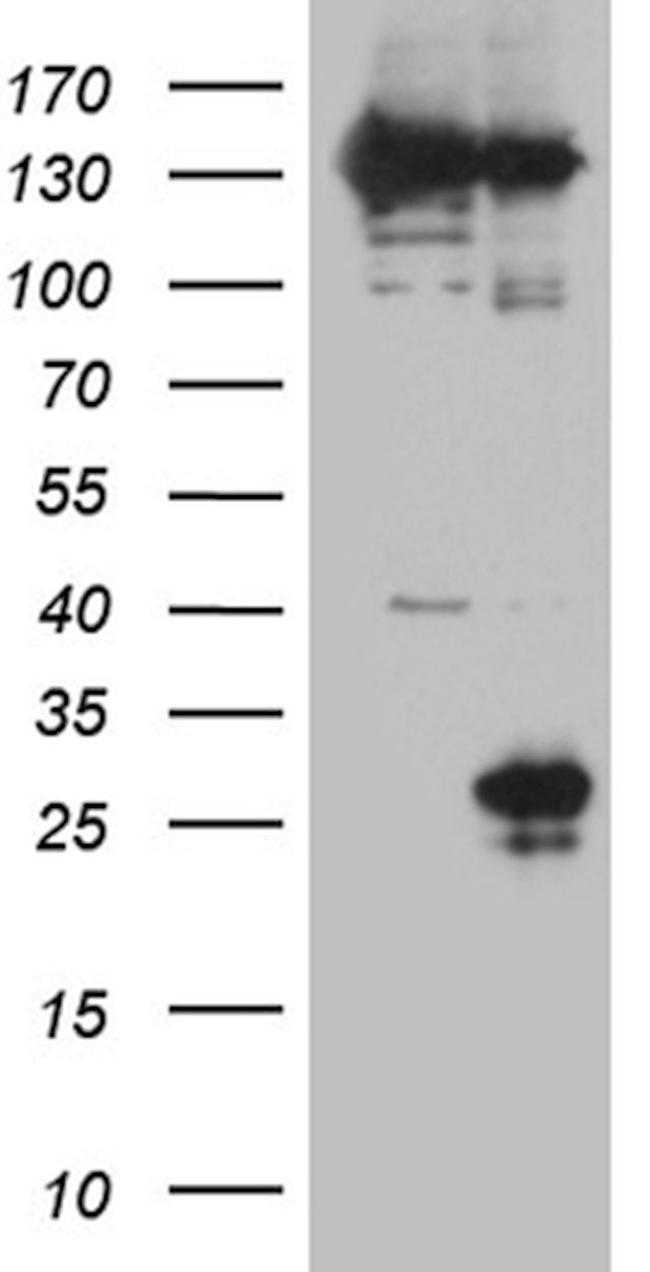 CD160 Antibody in Western Blot (WB)