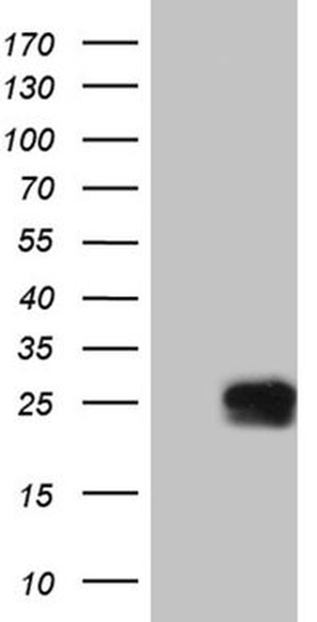 CD160 Antibody in Western Blot (WB)