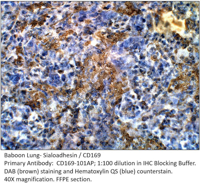 Sialoadhesin Antibody in Immunohistochemistry (IHC)