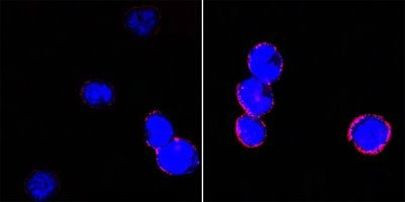 CD18 Antibody in Immunocytochemistry (ICC/IF)