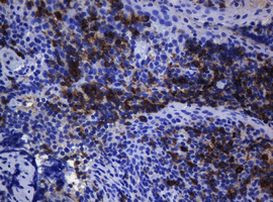 CD1C Antibody in Immunohistochemistry (Paraffin) (IHC (P))