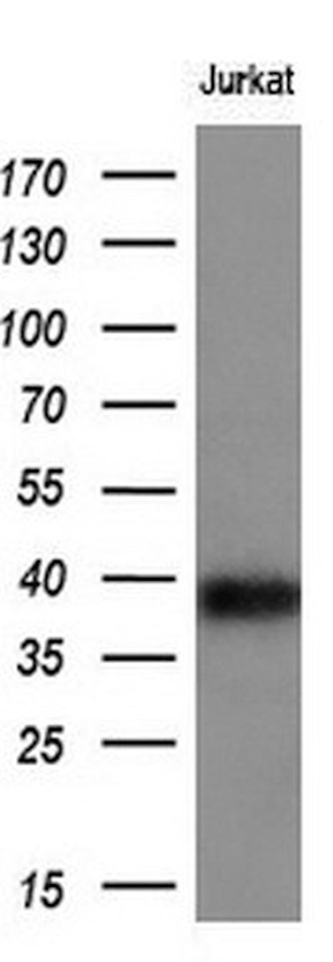 CD1C Antibody in Western Blot (WB)