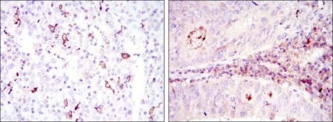 CD1a Antibody in Immunohistochemistry (Paraffin) (IHC (P))