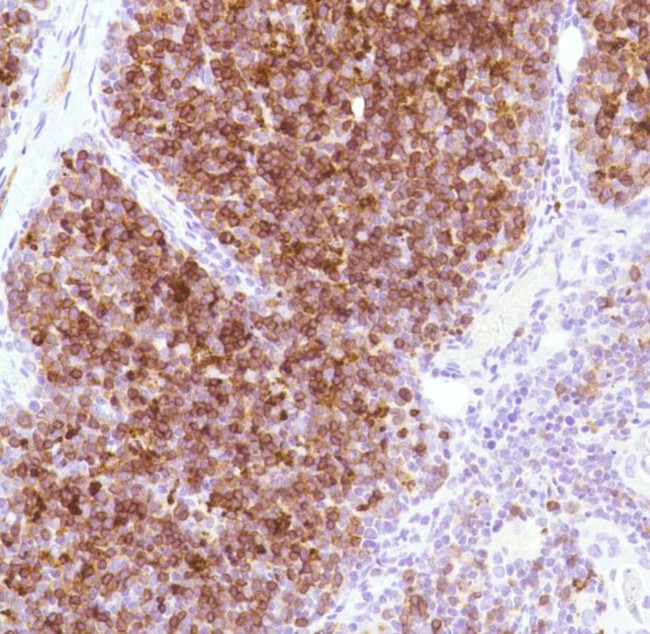 CD1a Antibody in Immunohistochemistry (Paraffin) (IHC (P))